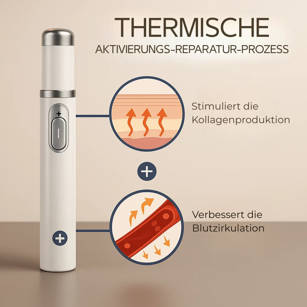 Revora - Krampfadern einfach lindern
