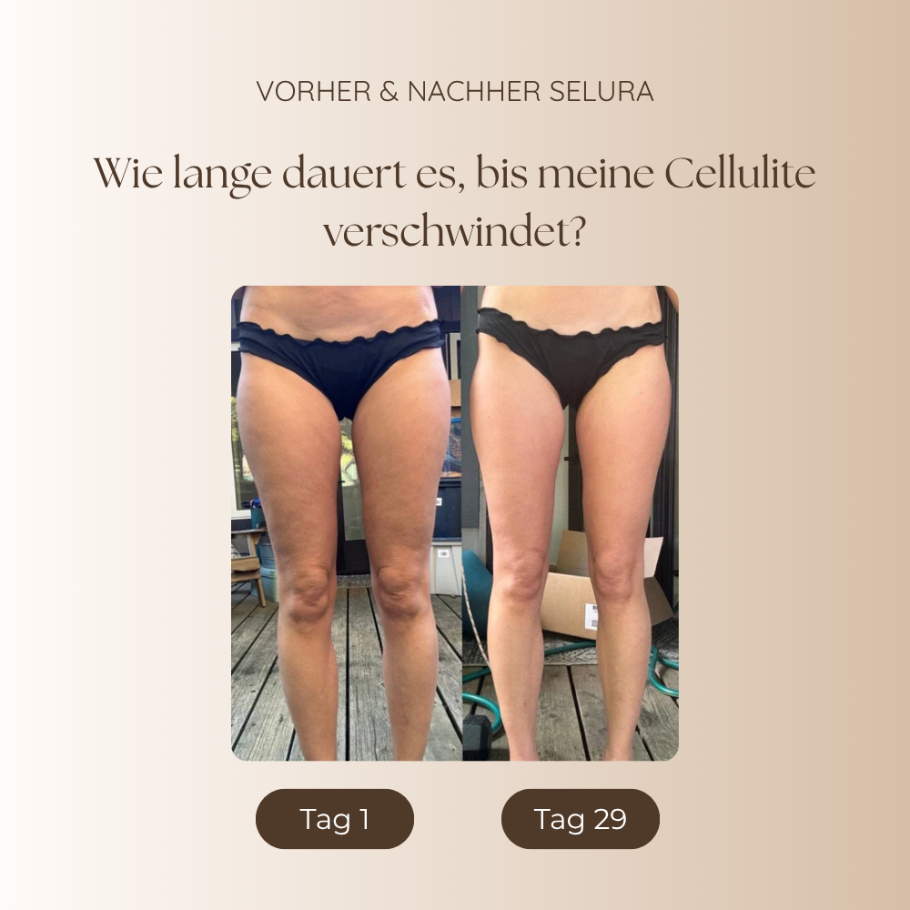 Selura – Glatte Haut & Fettverbrennung