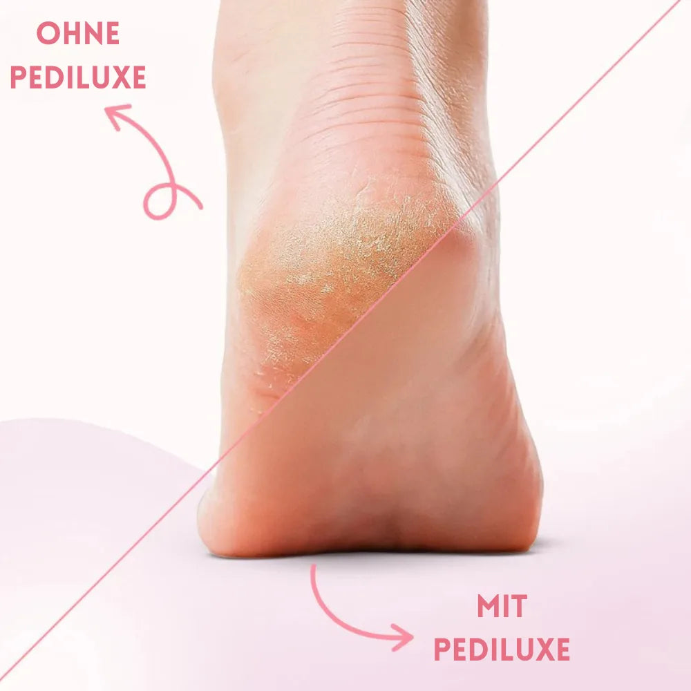 Pediluxe